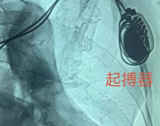6a266c883025b.png image.png